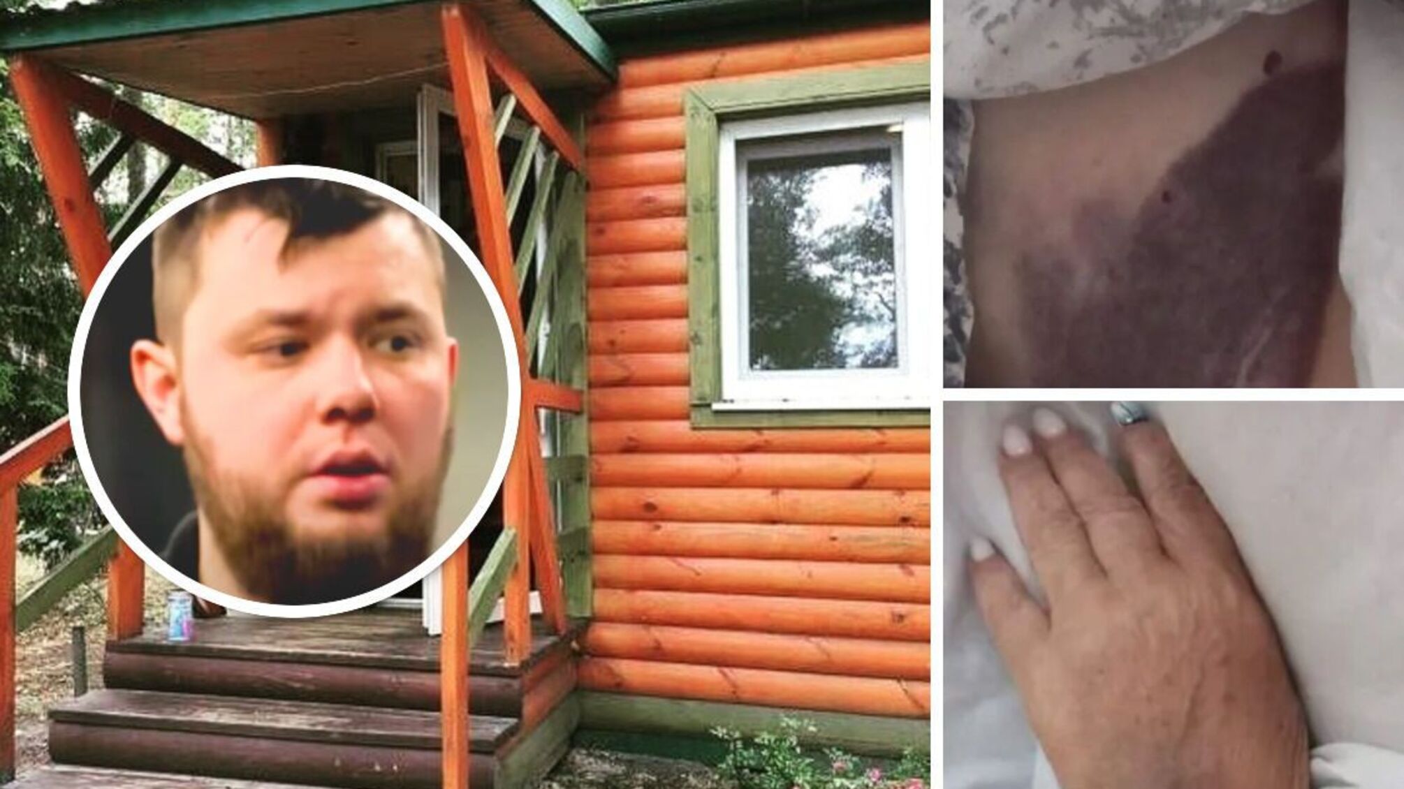 'Мажор', який до смерті забив жінку на базі відпочинку, може уникнути покарання?