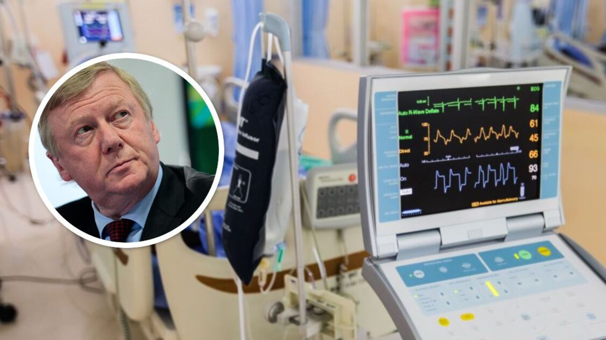 Анатолий Чубайс попал в реанимацию с редкими симптомами