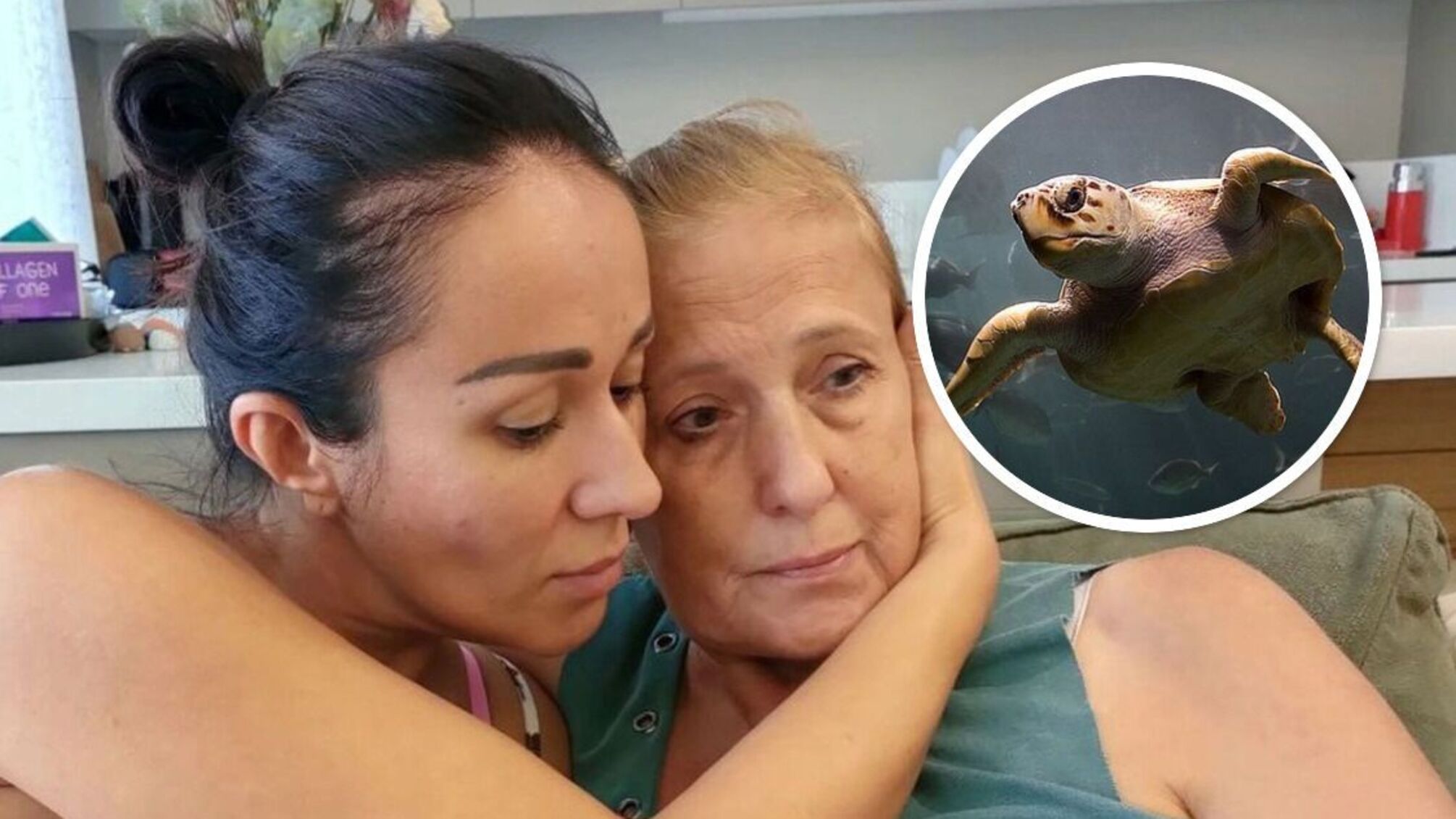 Пережила справжній жах: у Туреччині черепаха покусала російську туристку