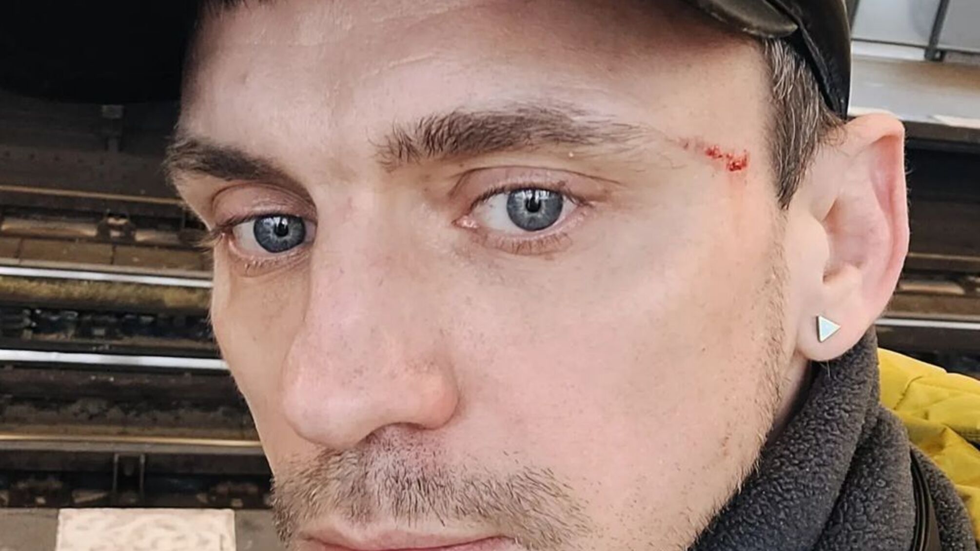 Избили из-за значка с флагом: в Берлине неизвестный напал на украинца