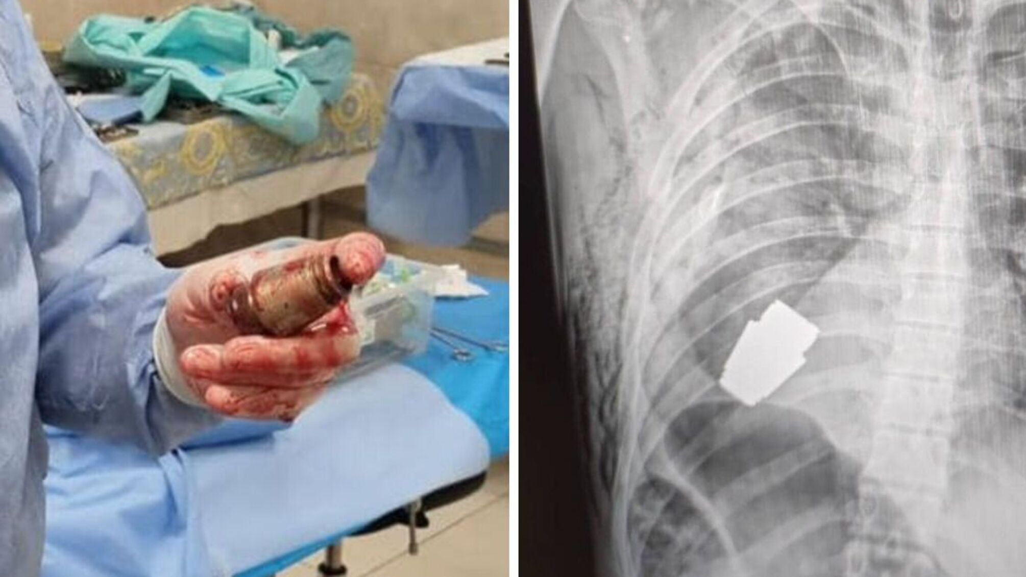 Граната ВОГ