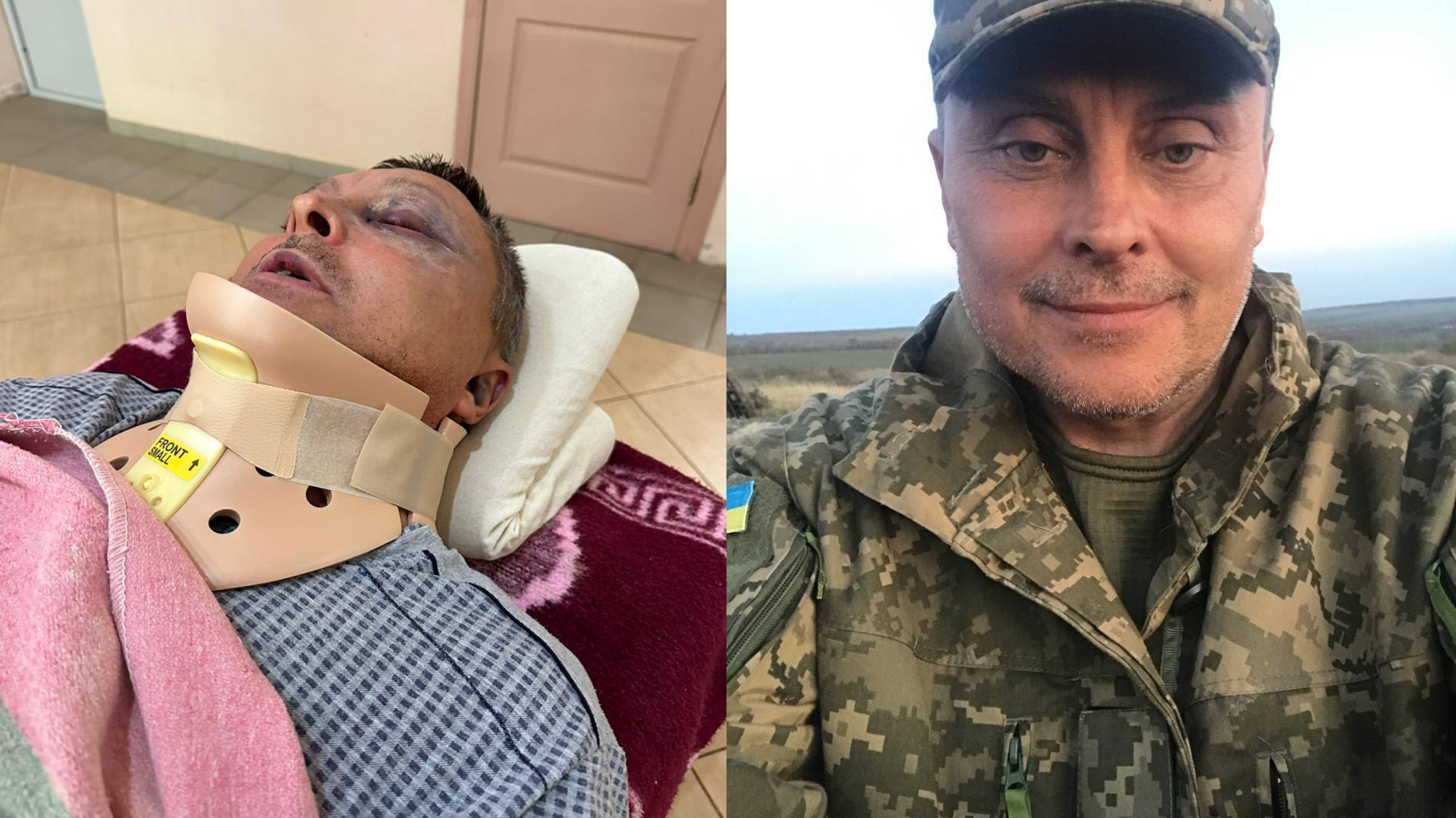 На Одещині невідомі побили військового – він госпіталізований з переломом шиї
