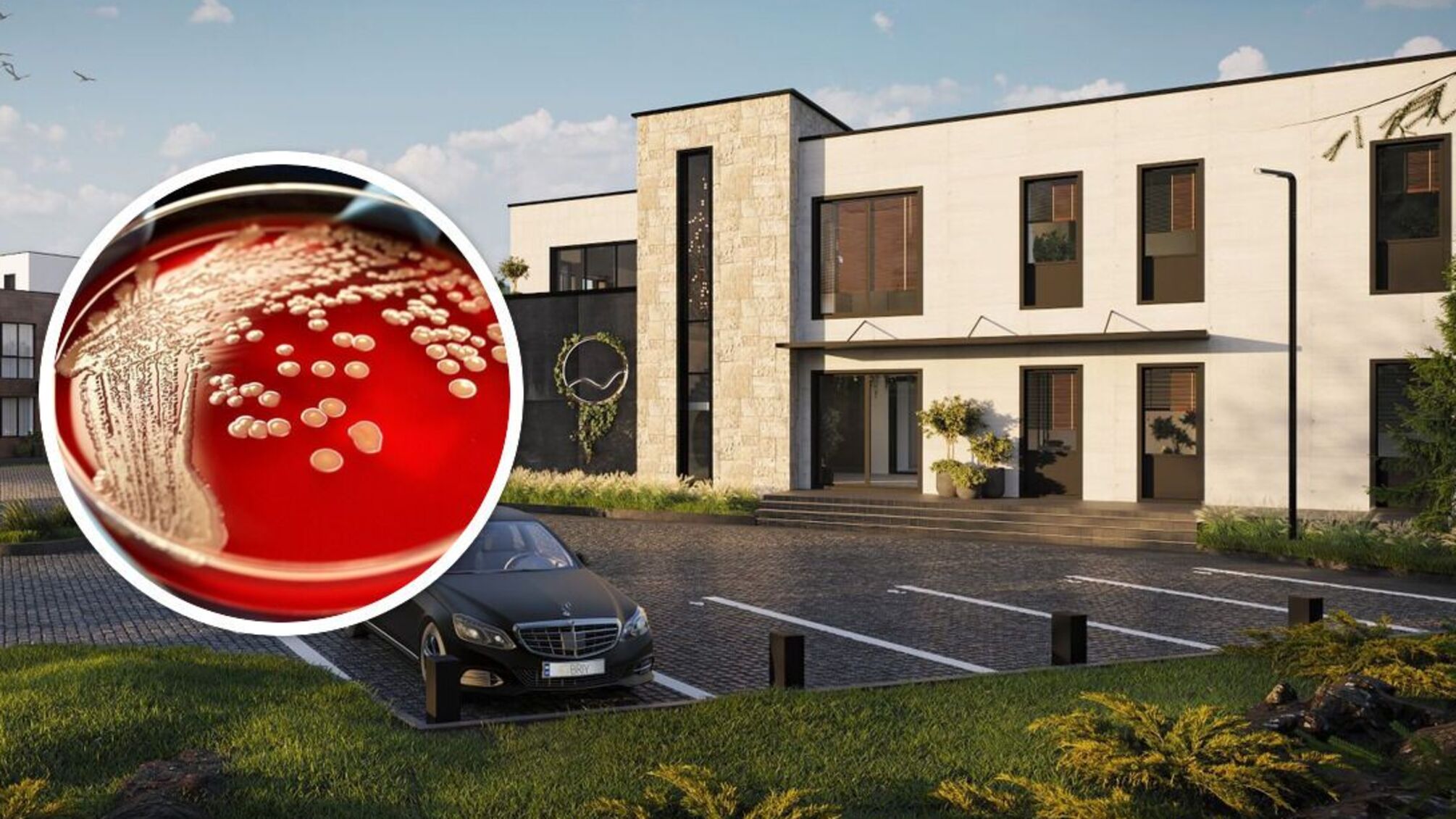 сибірська язва км обрій