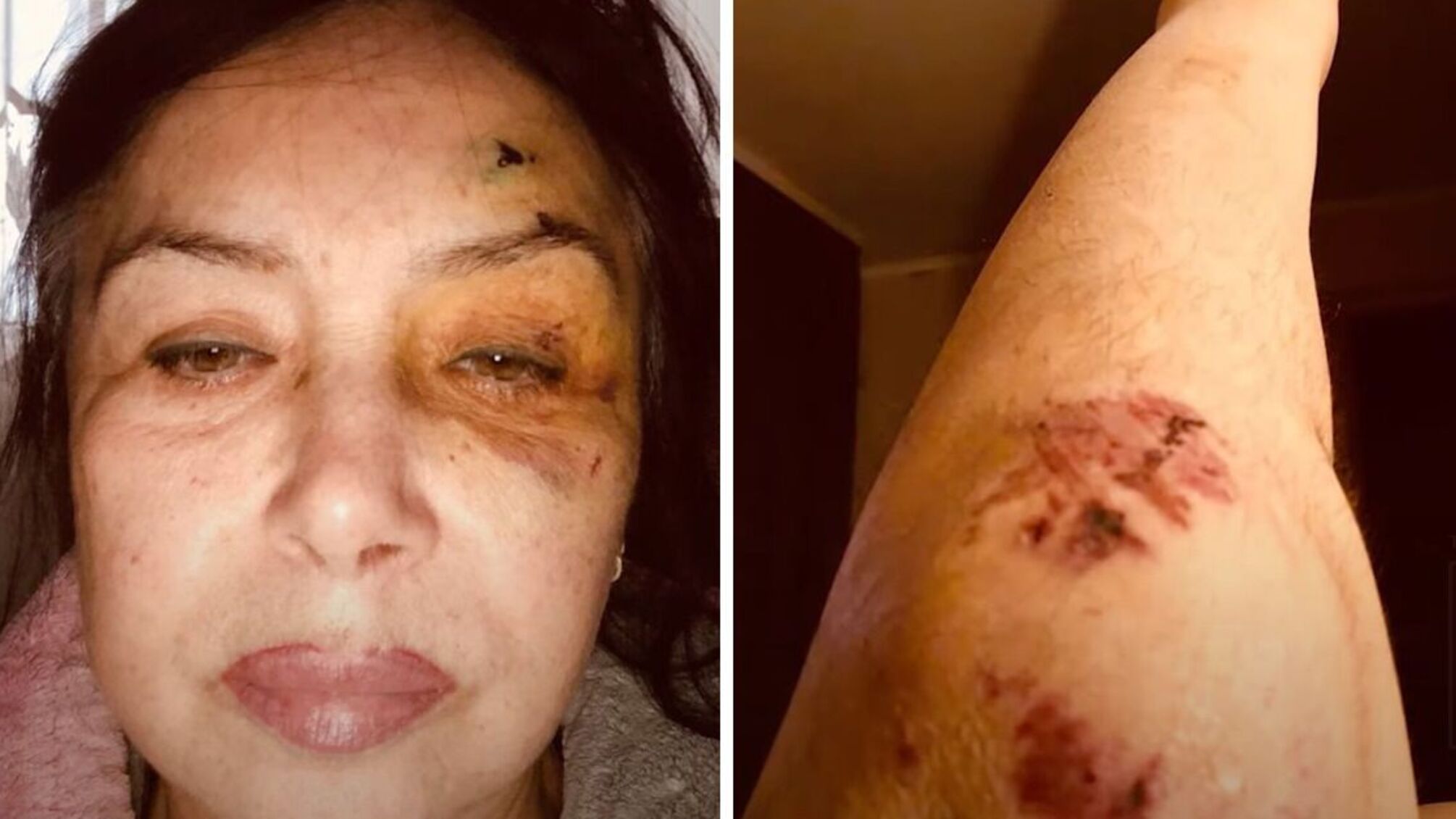 На Київщині молодий сусід тероризує пенсіонерку, а поліція бездіє?