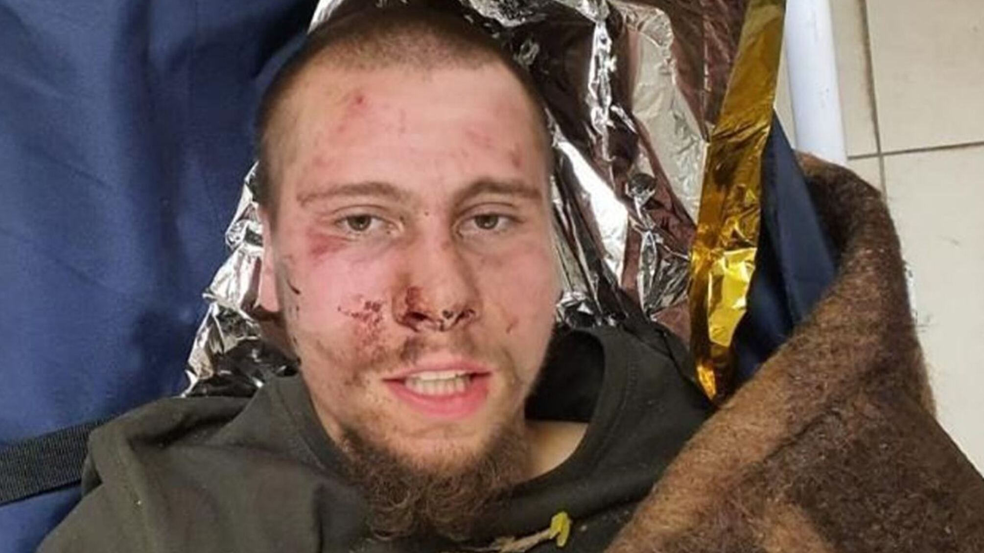 Задержанный сразу пытался выдать себя за «рядового» боевика