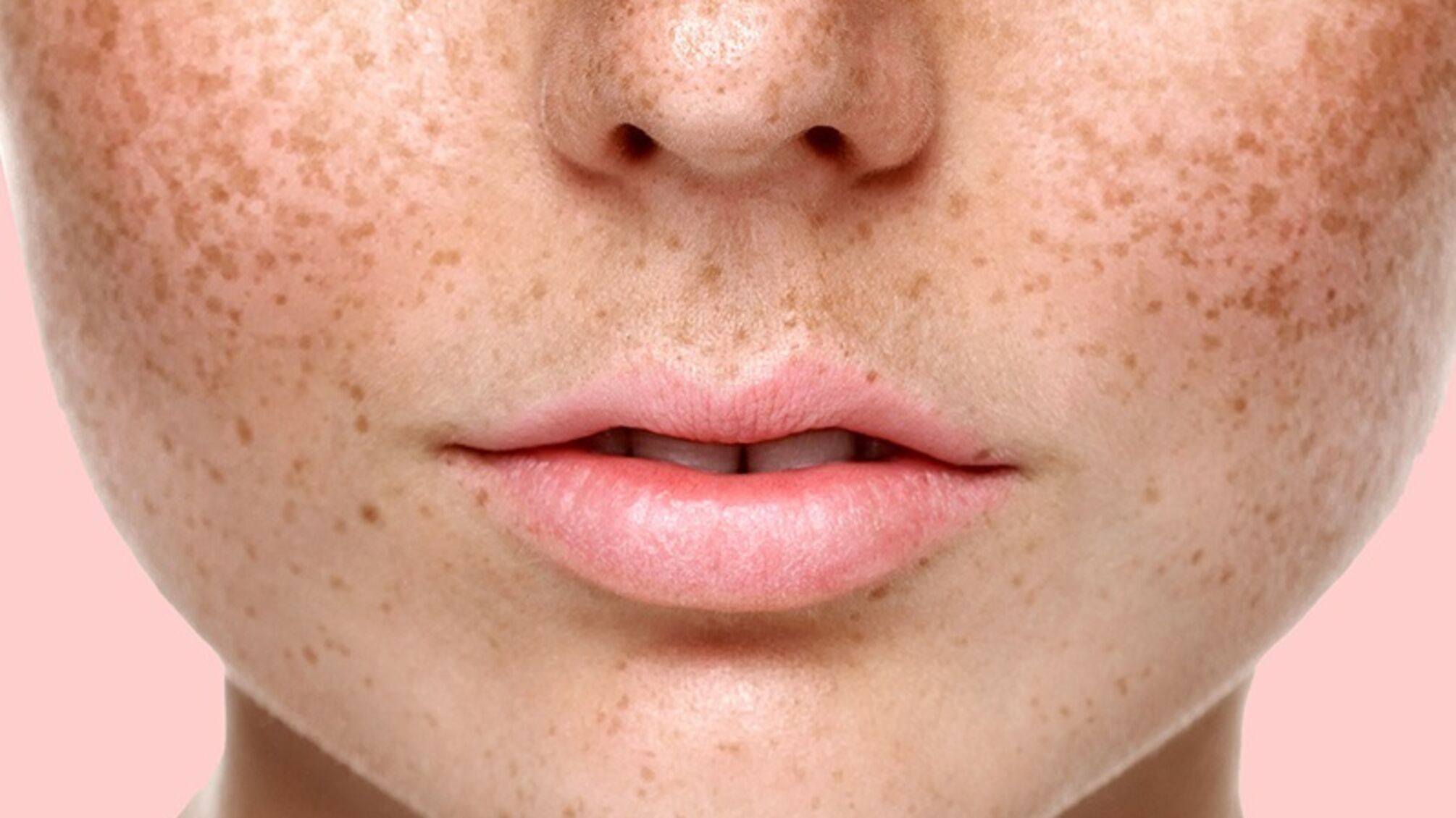 пигментация