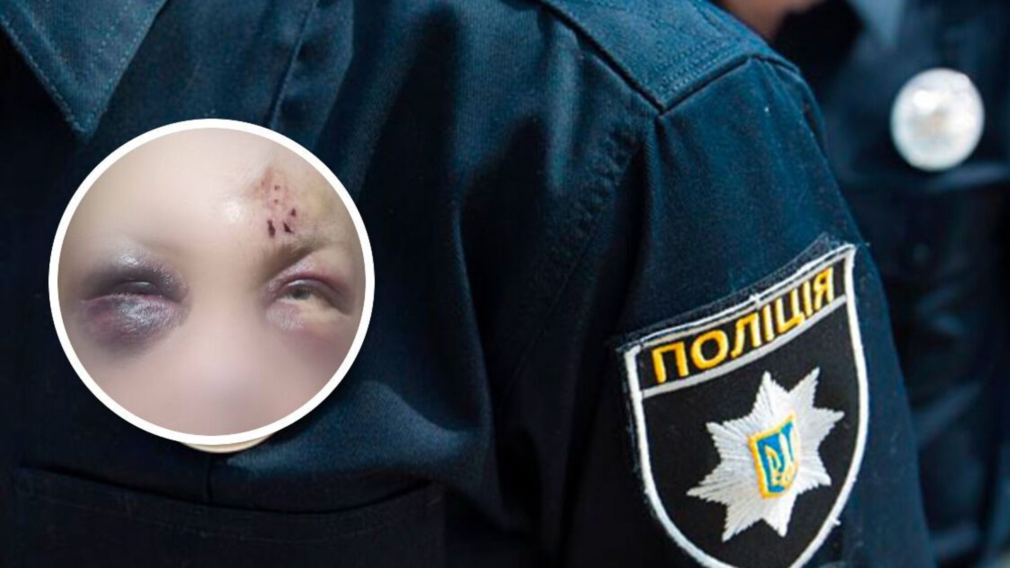 У Житомирі військовослужбовець ЗСУ заявив про напад на його дружину: що відомо