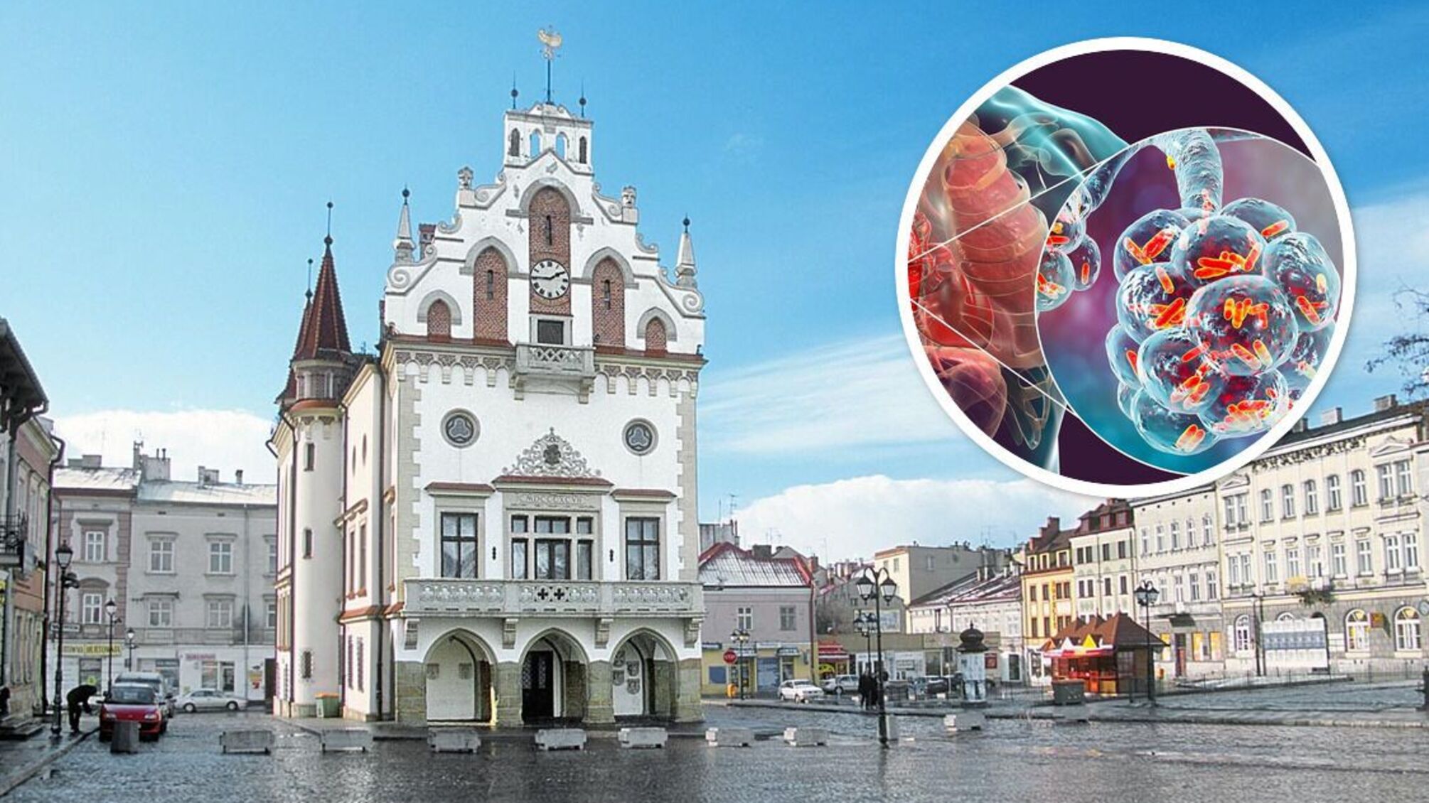 Жешув, спалах інфекції, хвороба легіонерів