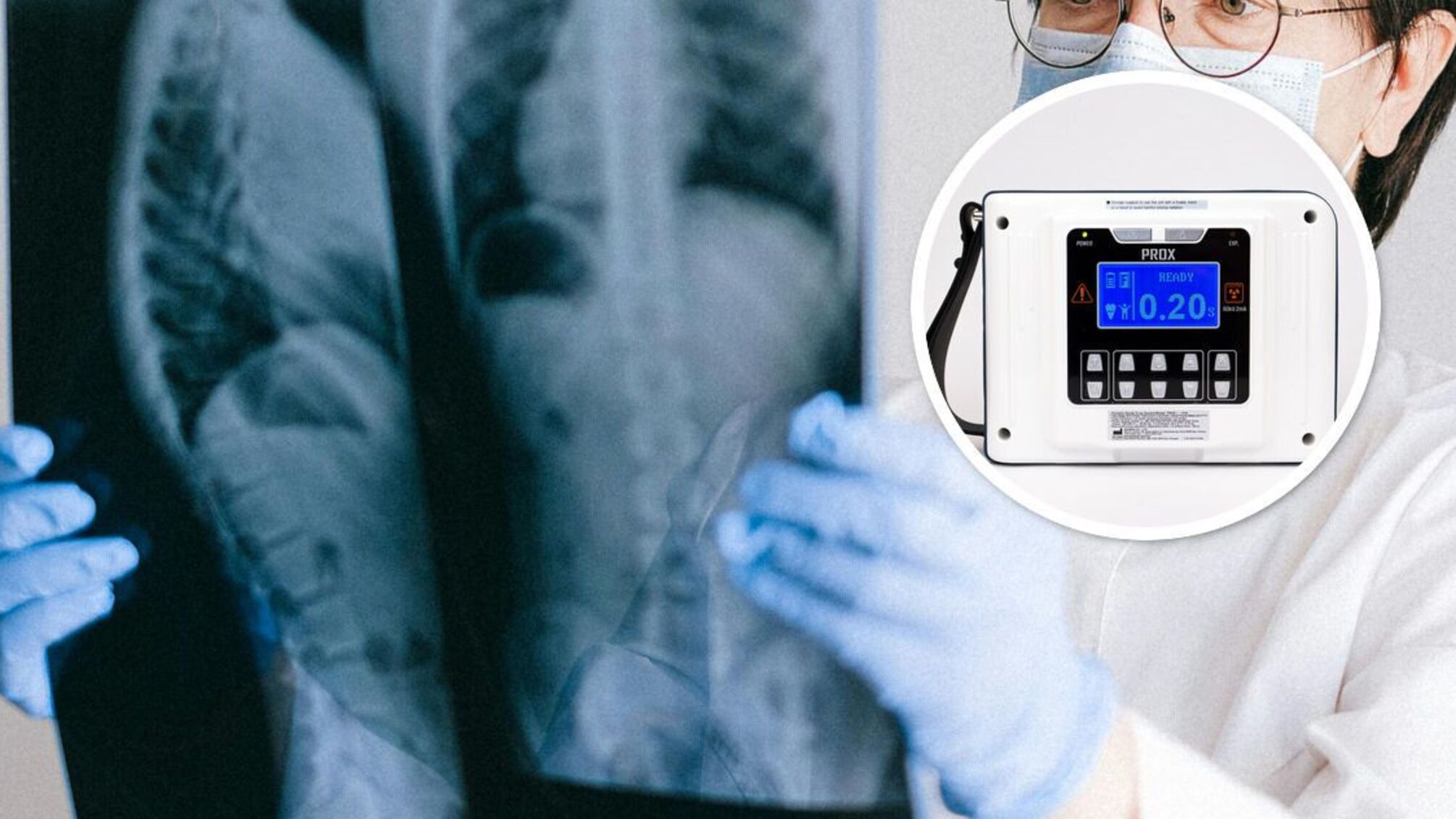 Украина получила портативные рентген-аппараты