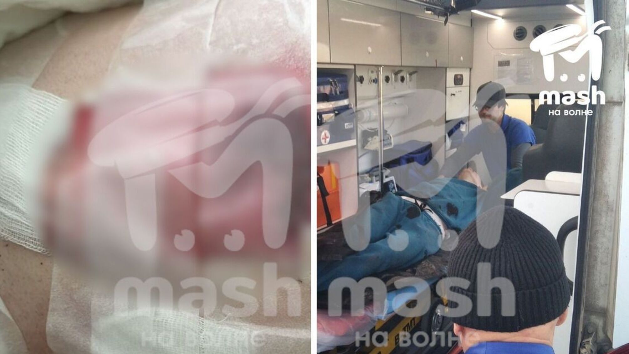 В Крыму россияне выстрелили в мужчину