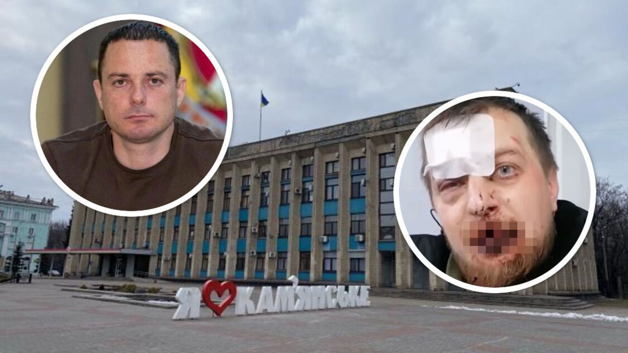 В Каменском избили участника акции 'Деньги на ВСУ': к нападению могут быть причастны городские власти?