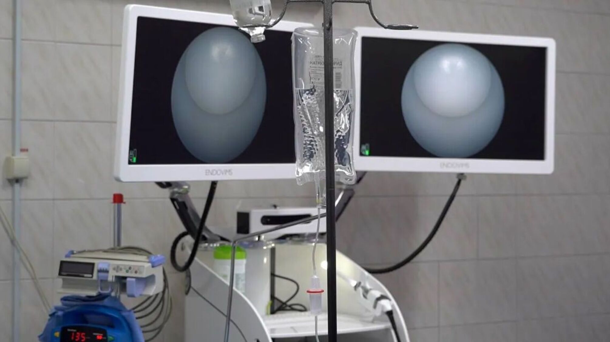 Медоустройство на 7,6 млн грн получили больницы Харькова, Киева и Донбасса от БФ 'Надежда' и Фонда Д. Парамонова