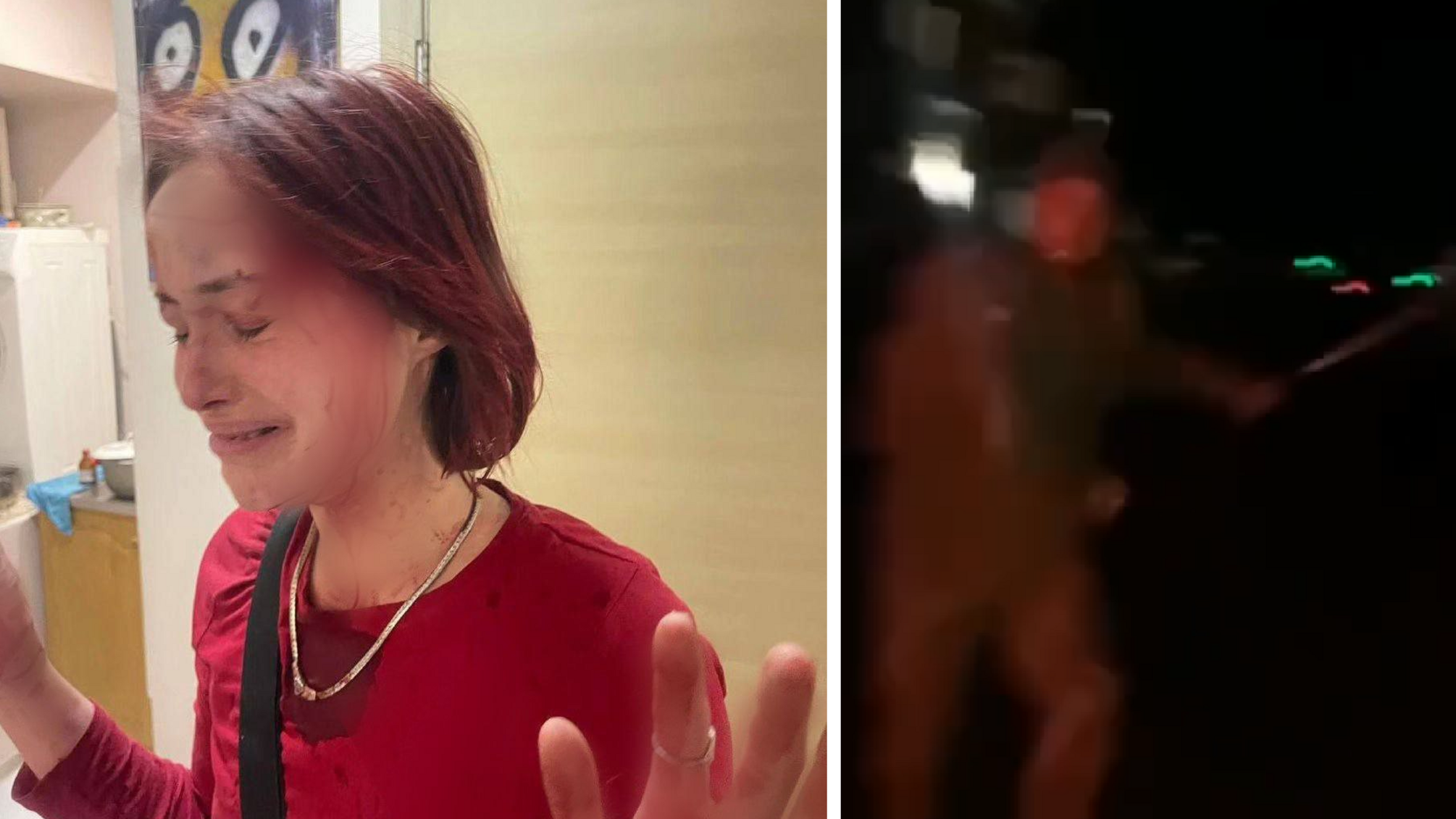 Одеситка стверджує, що працівник військомату побив її