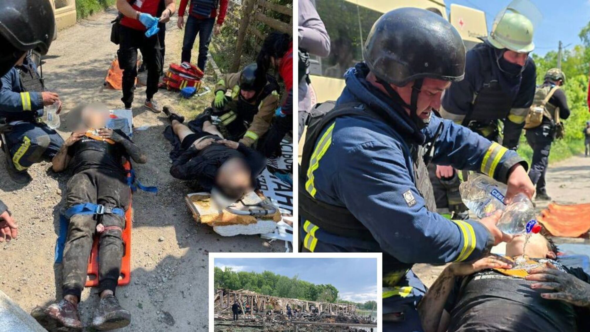 Надання першої допомоги з кисневою маскою