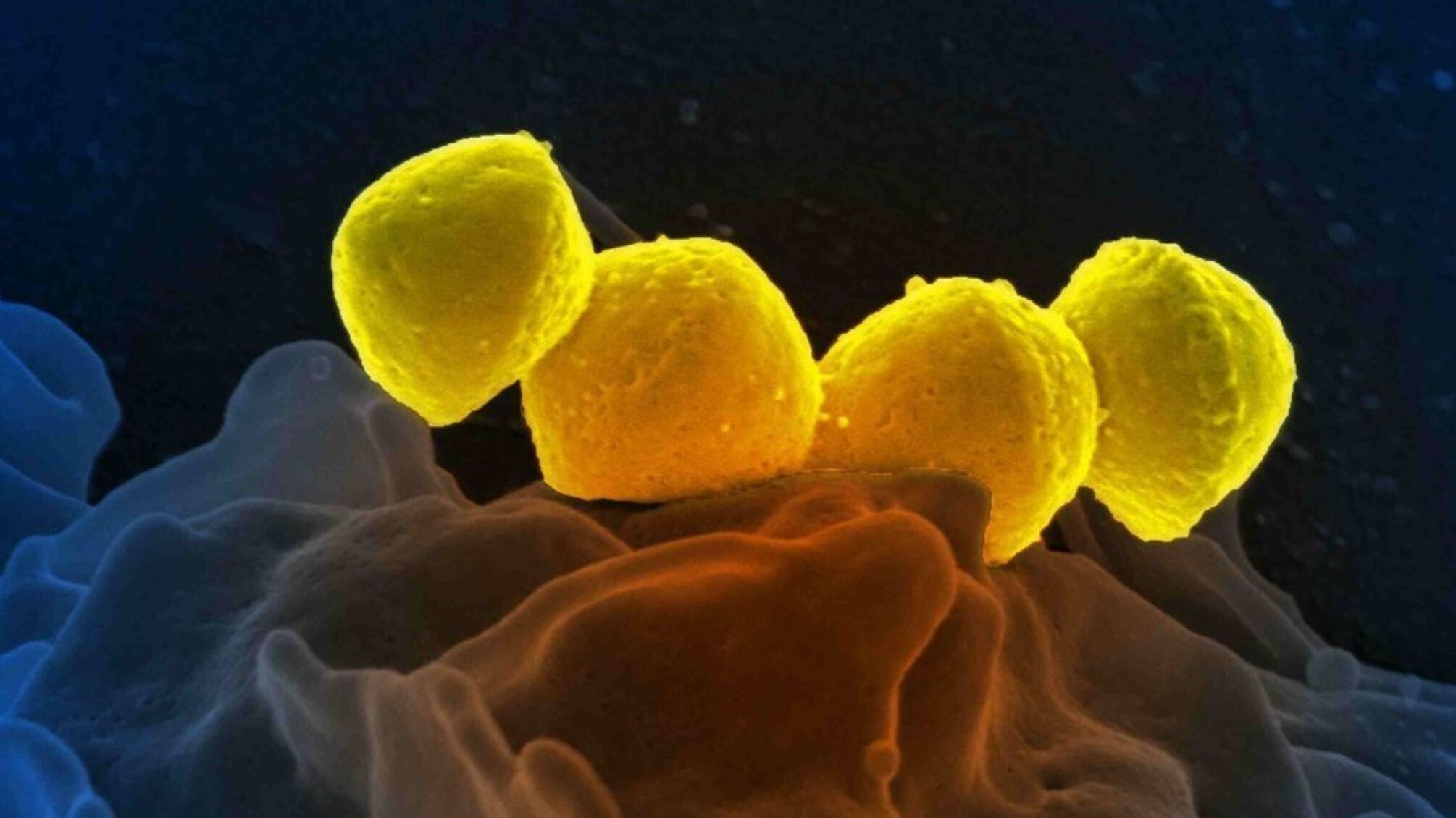 Смертельная мясоядная бактерия распространяется в Японии, уже более 900 случаев заболевания