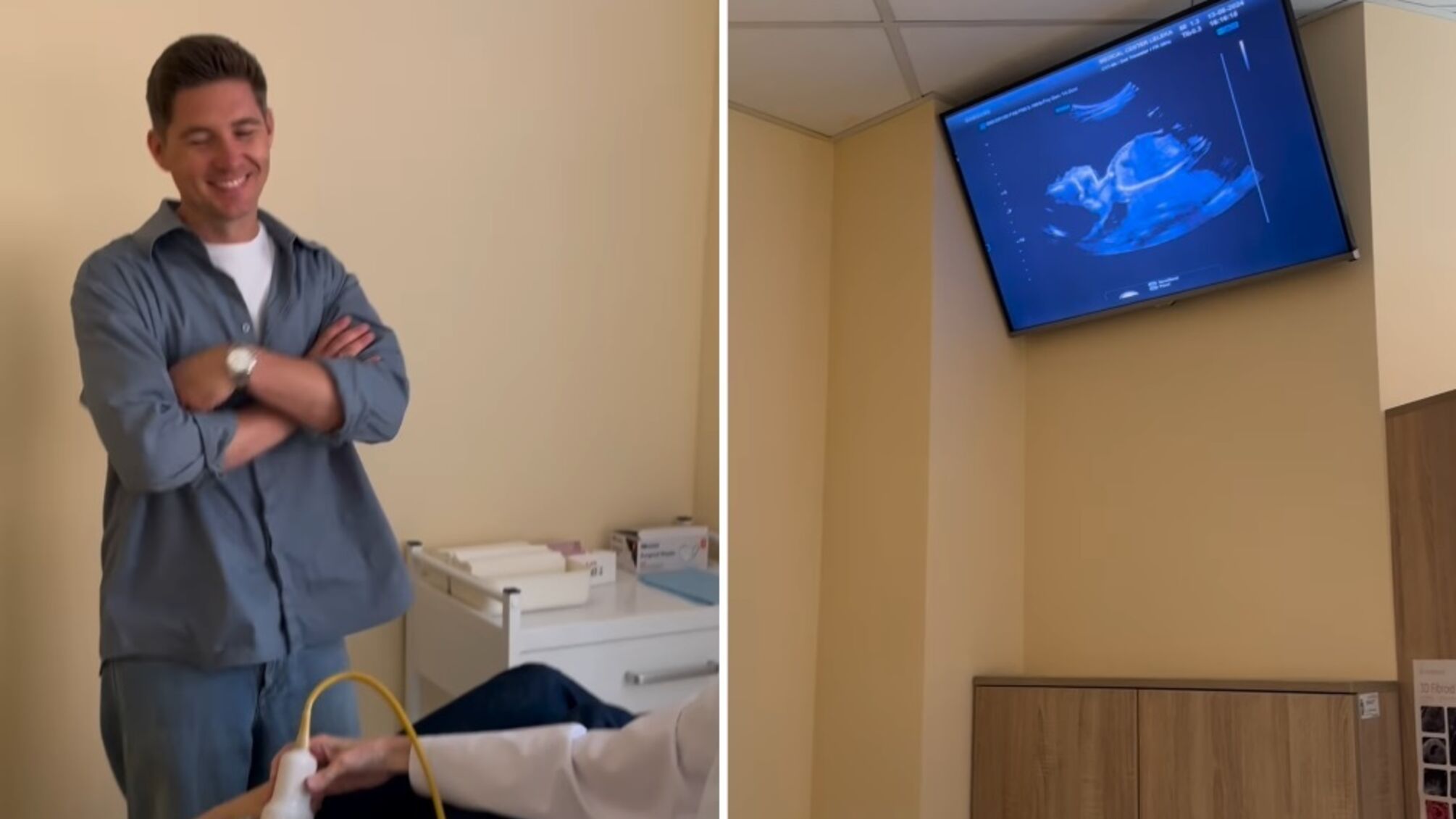 Володимир Остапчук чекає на сина: зворушливе відео з УЗД