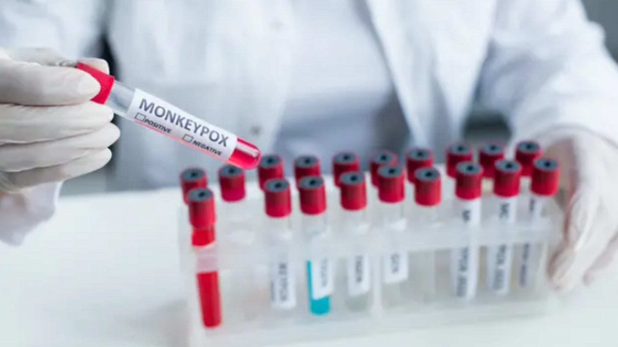 ВОЗ подтвердила первый в Европе случай заболевания оспой обезьян