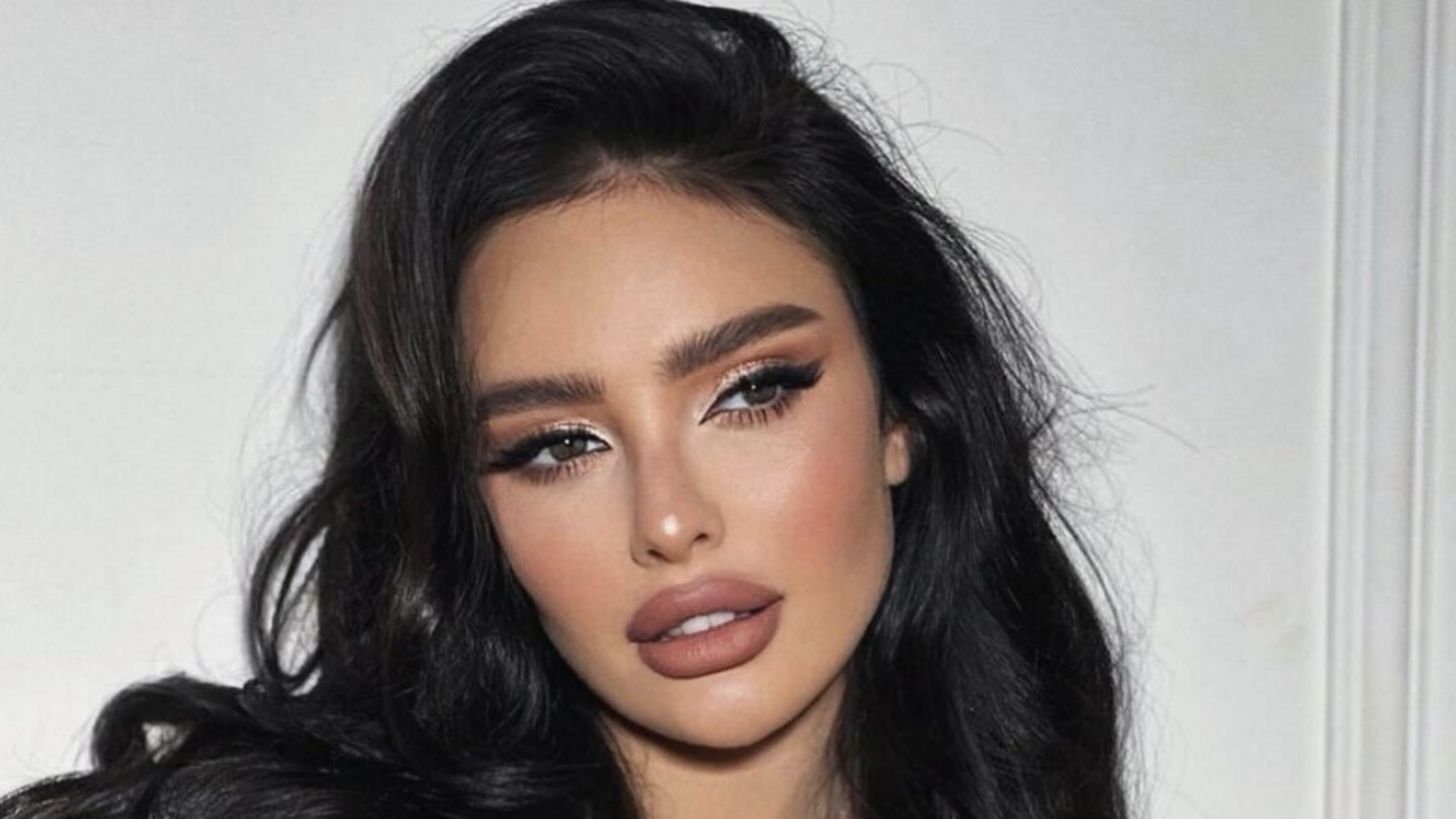 Безліч гематом: відома українська блогерка заявила про насильство з боку ексбойфренда (фото)