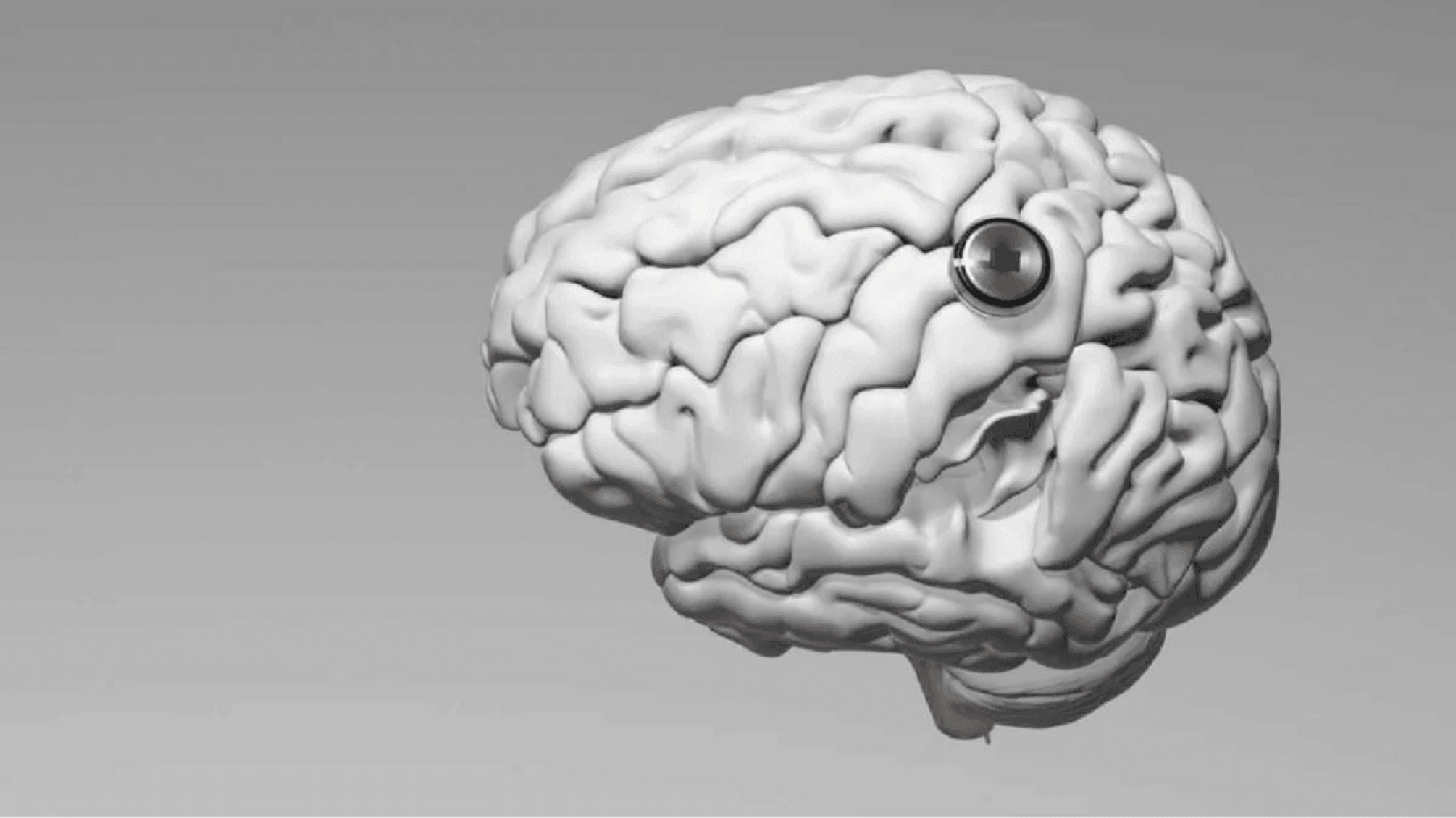 «Мозок-комп’ютер» повністю імплантований, косметично невидимий