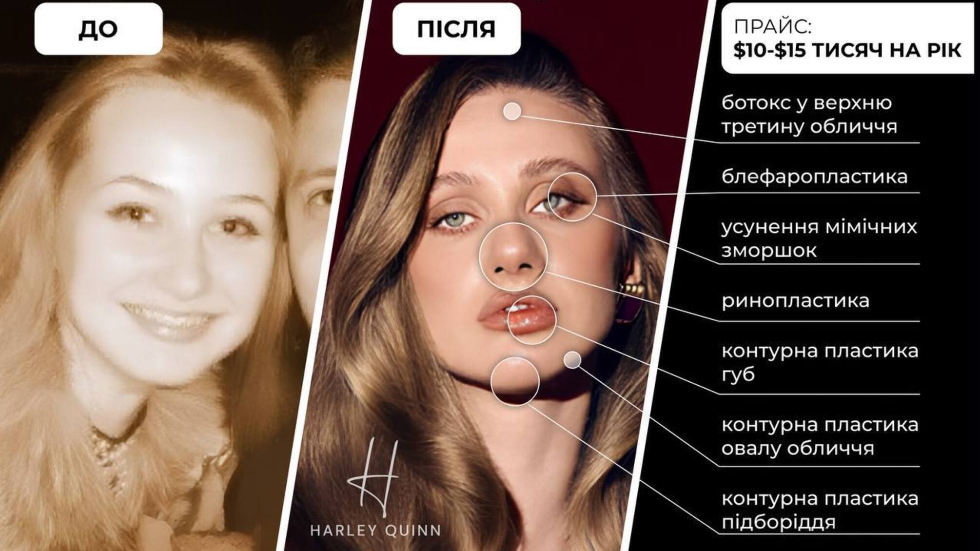 Красота стоимостью автомобиля: сколько тратит эксдружина Тищенко на себя?