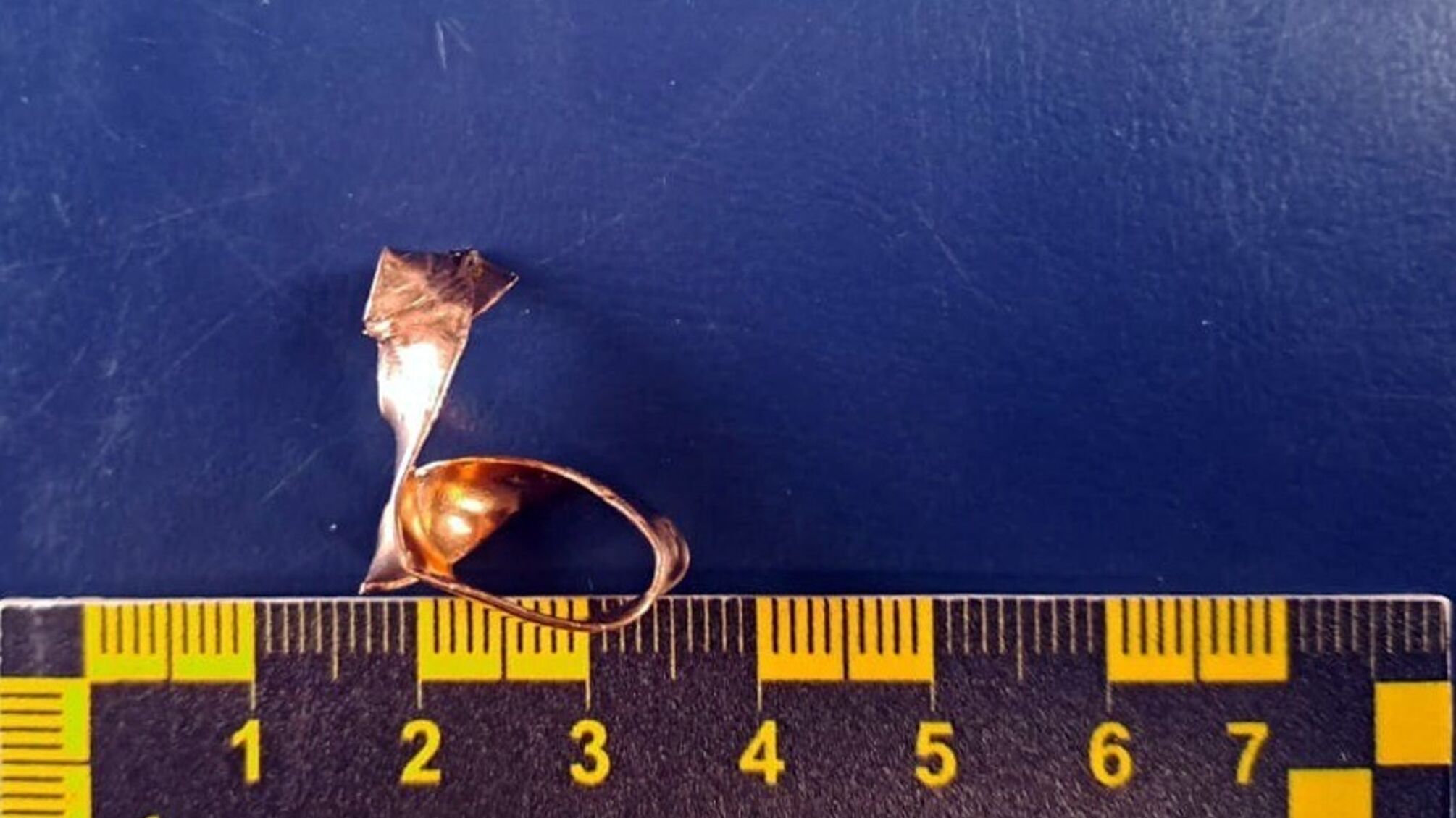 Золоту обручку з руки захисника зрізали у морзі