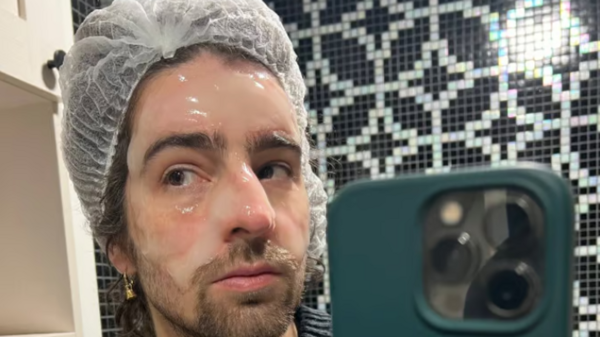 Дантес показал, на какую beauty-процедуру отважился у косметолога