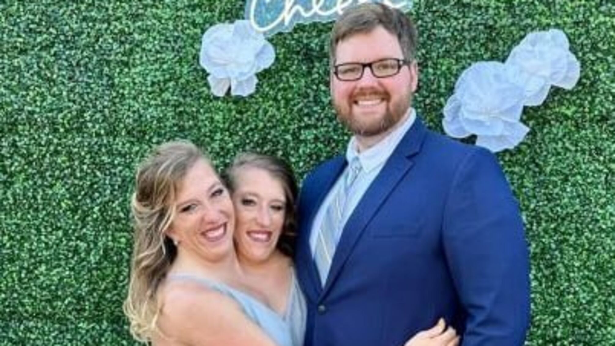 Сиамские близнецы из Миннесоты готовятся к пополнению в семье