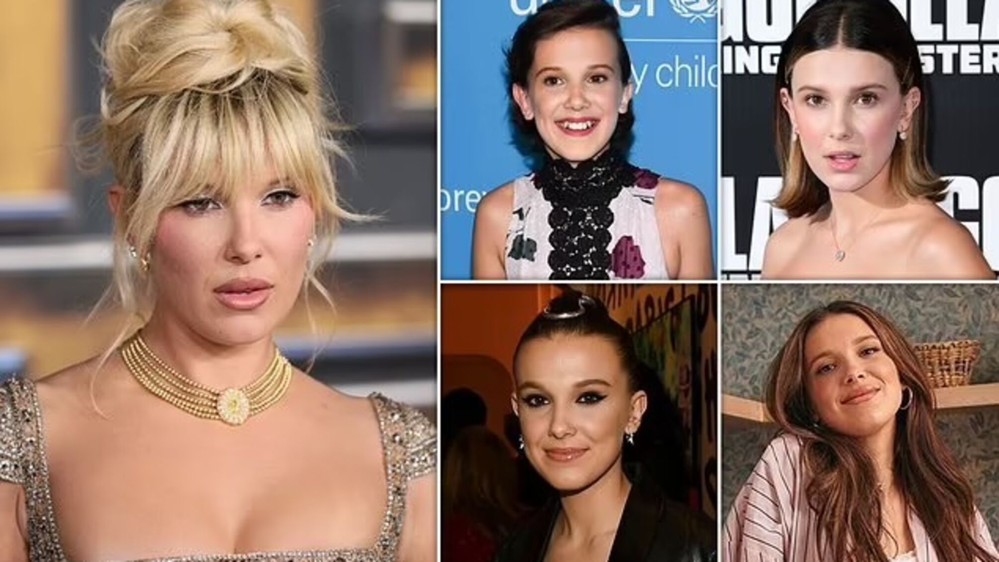 Чи робила Міллі Боббі Браун косметичні процедури? Експерти пояснили зміни у її зовнішності