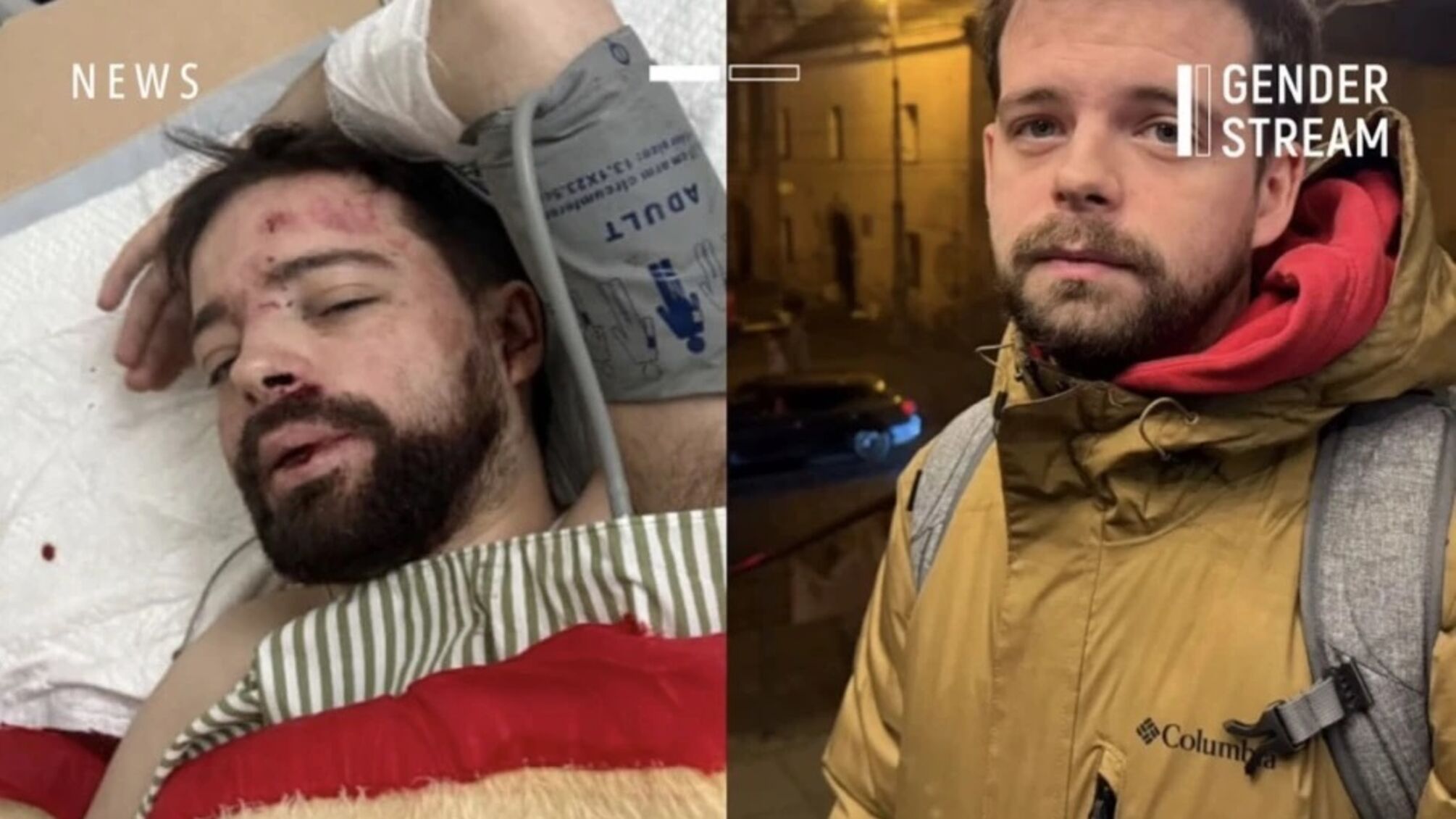 Зникнення Степана Більченка: чоловіка знайшли з тяжкими травмами в Житомирській області