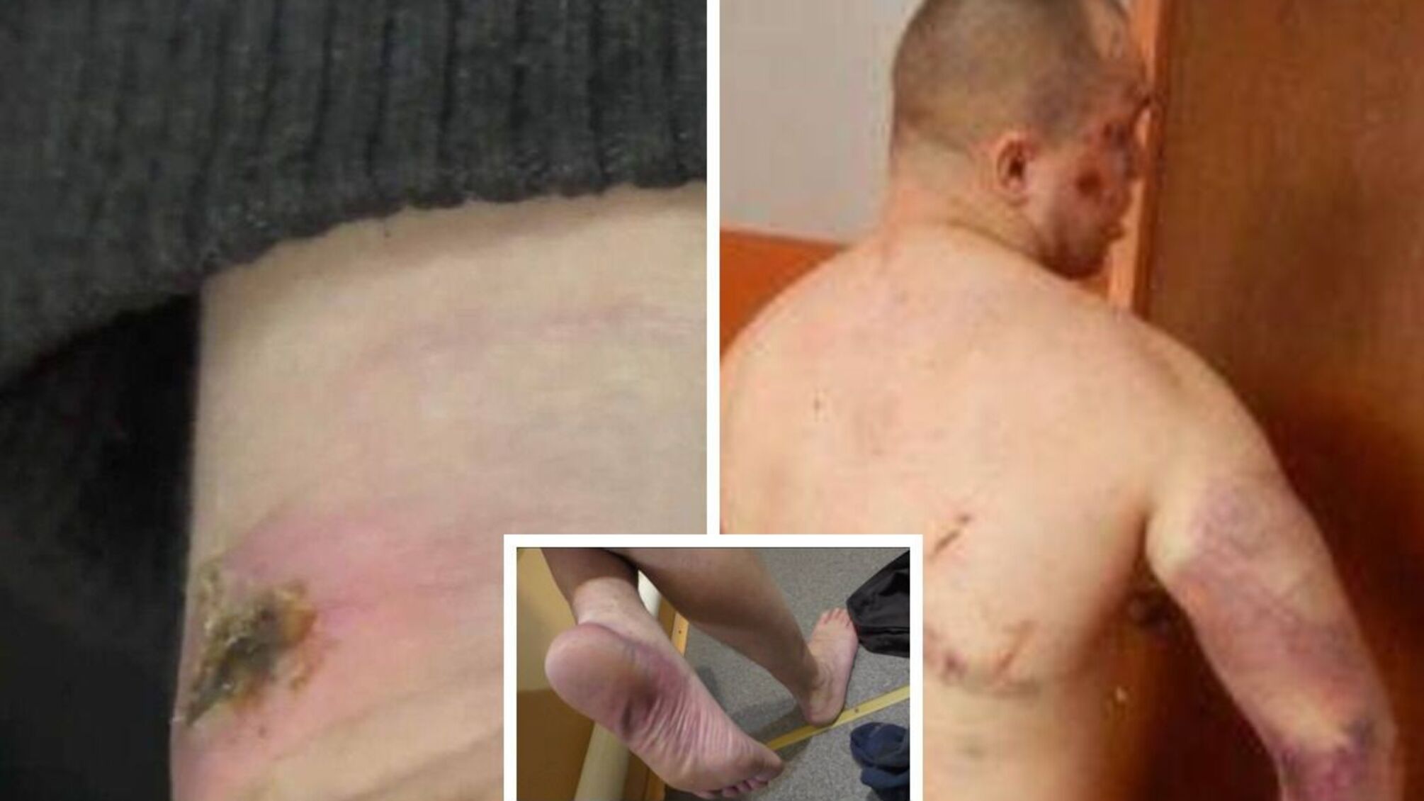 ДБР задержало еще одного участника массовых пыток осужденных