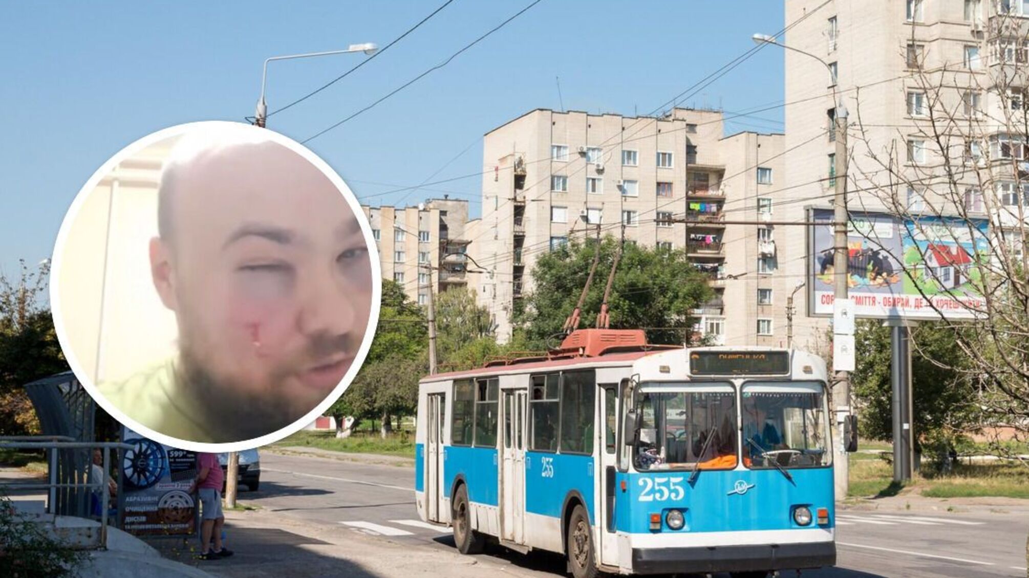 Трое мужчин избили ветерана в Виннице: замечание о шуме закончилось потасовкой