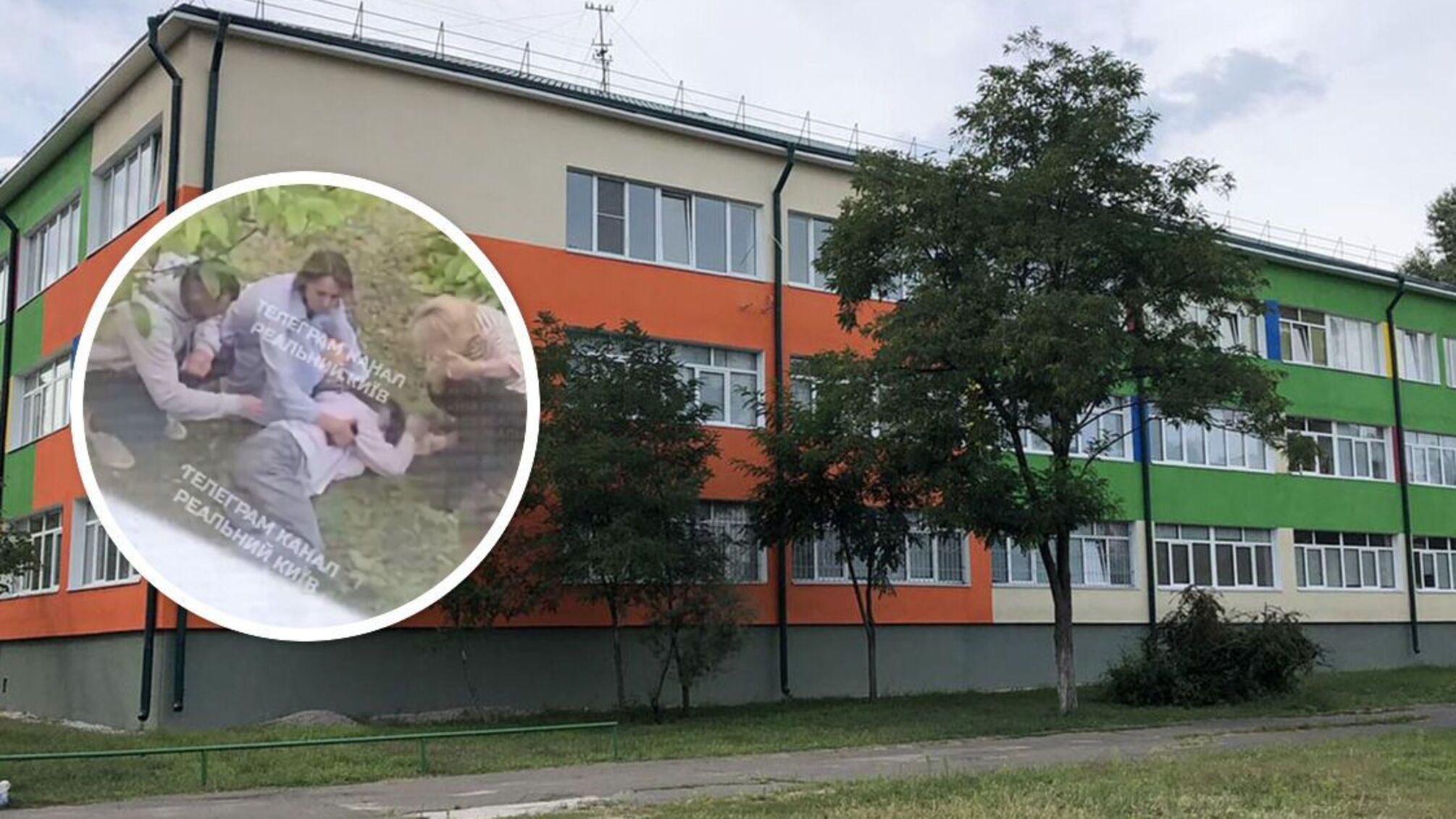 14-річна учениця отримала травми після падіння з вікна школи в Києві