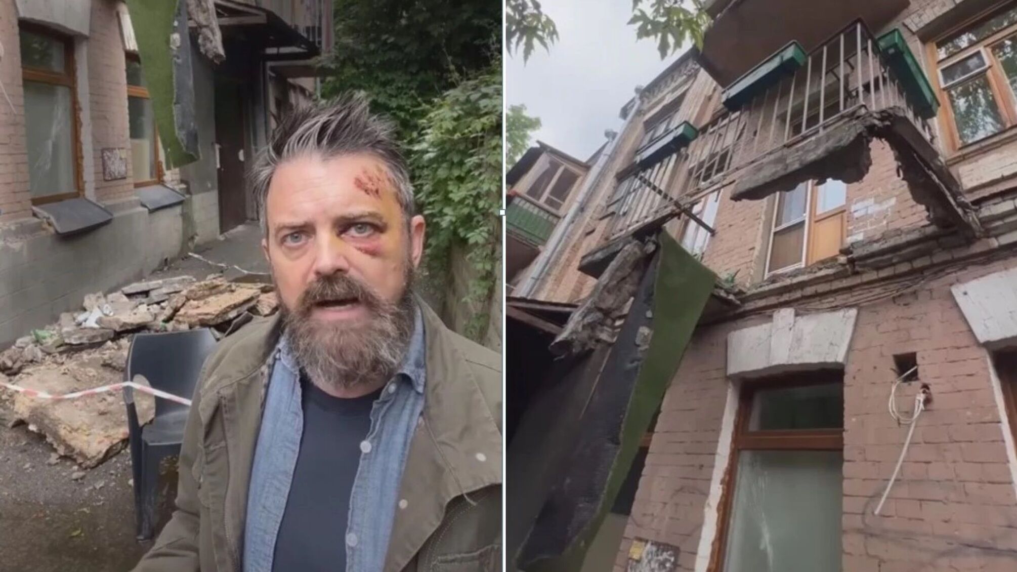 Гражданин США пострадал из-за обвала балкона в Киеве