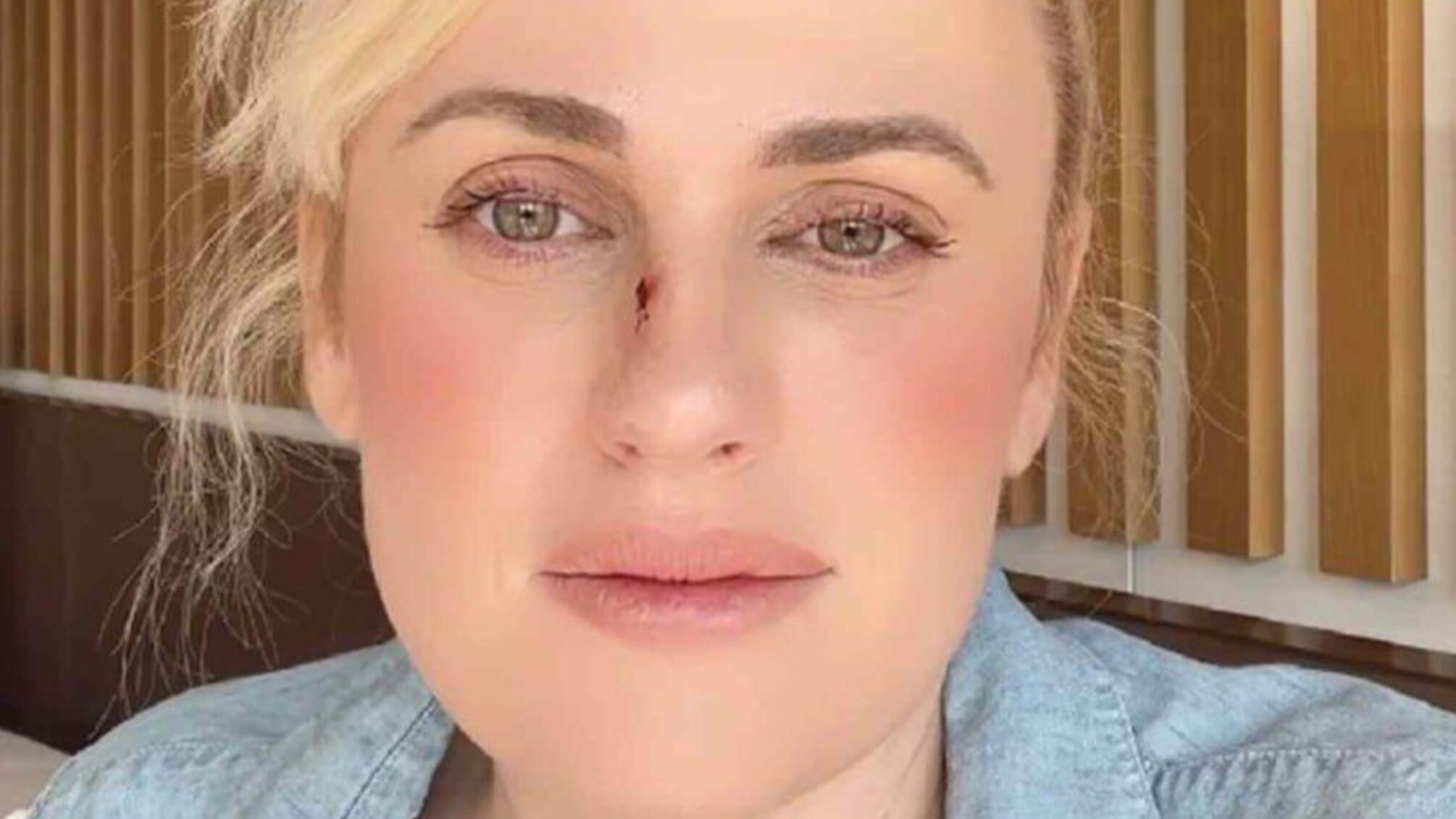 Ребел Вілсон розповіла про травму на зйомках «Шпигунського весілля», через яку знадобилася операція