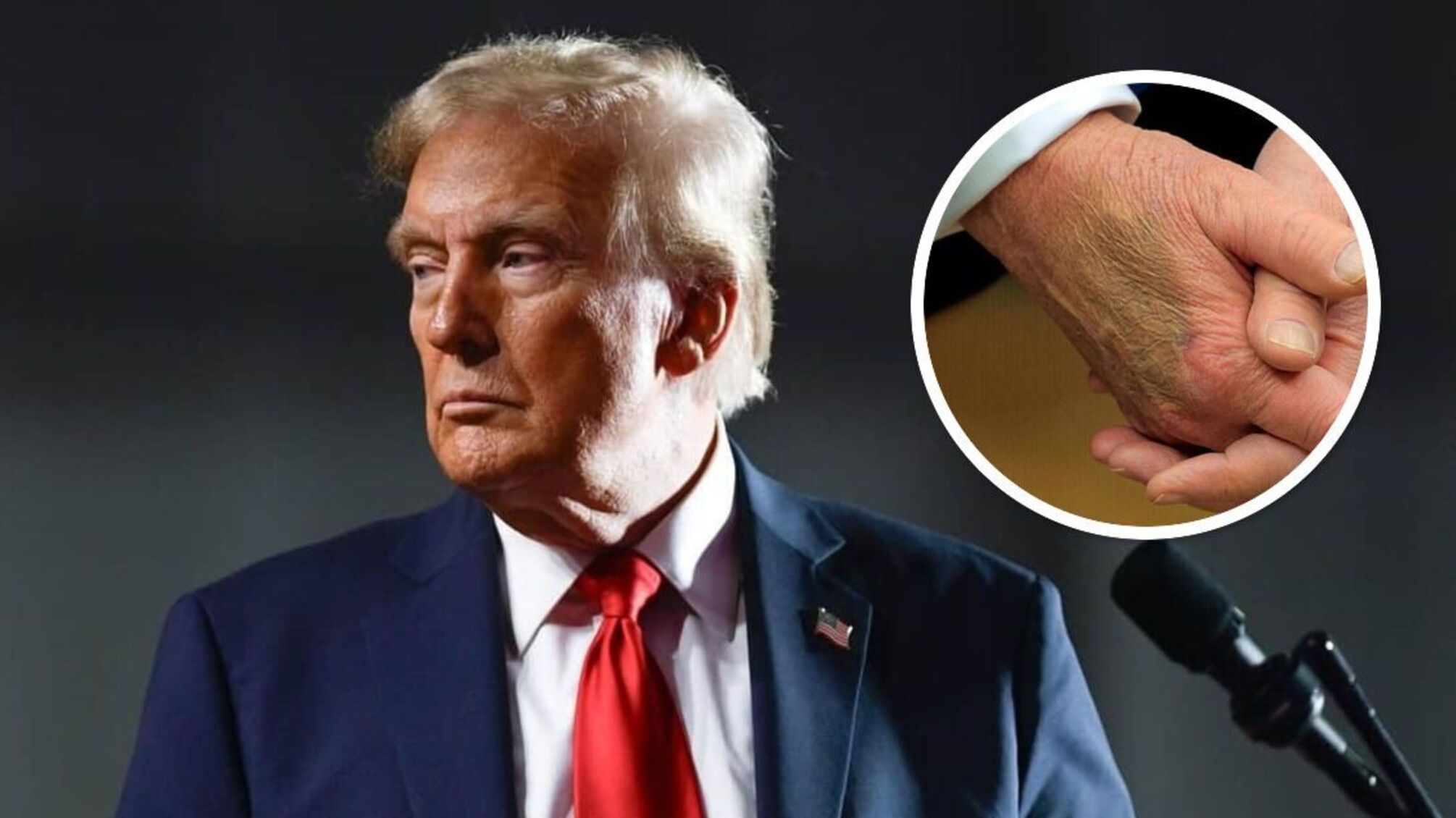 У Трампа проблеми з венами — Білий дім запевняє, що загрози немає