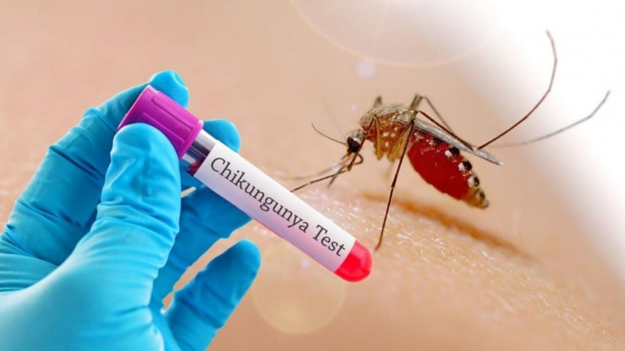 У рф фіксують комарів, які переносять смертельний вірус