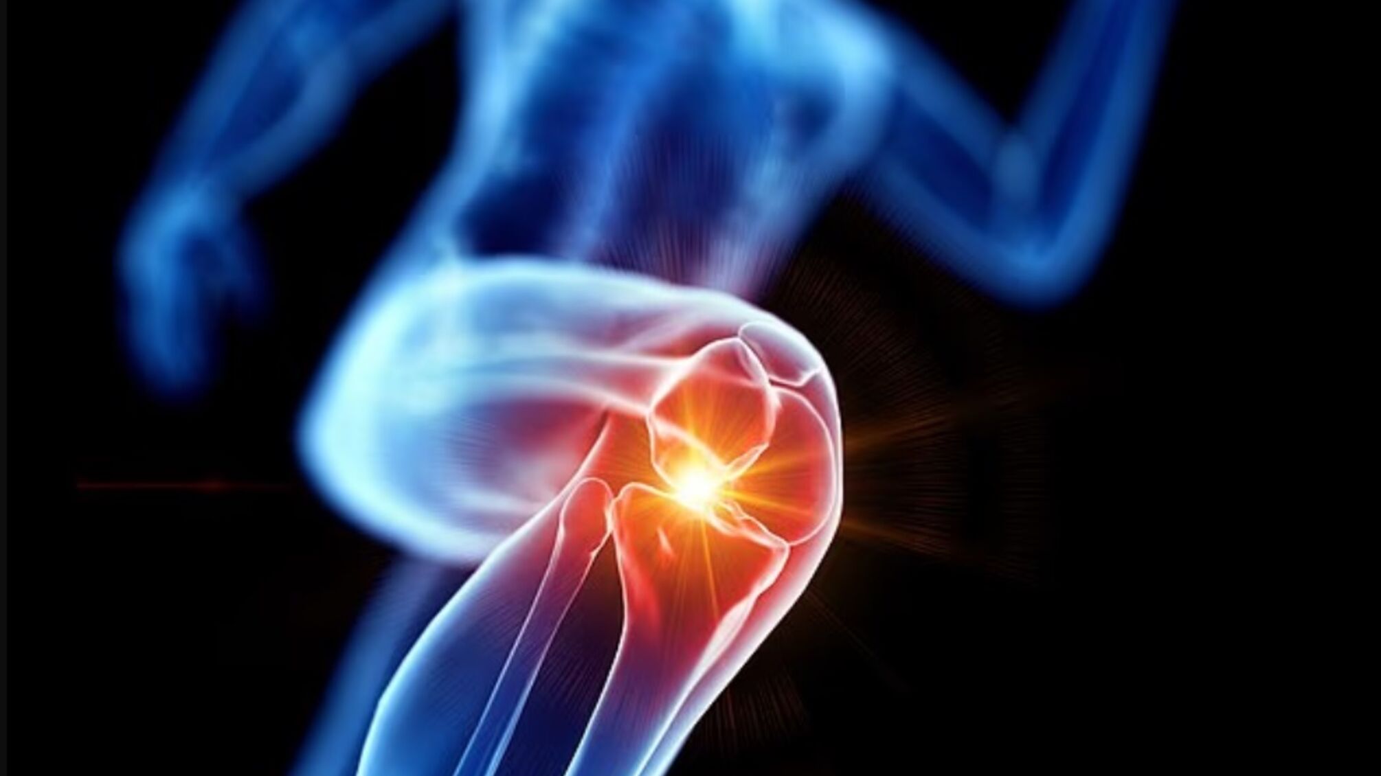 Как избежать операции на коленях: шесть советов от врачей