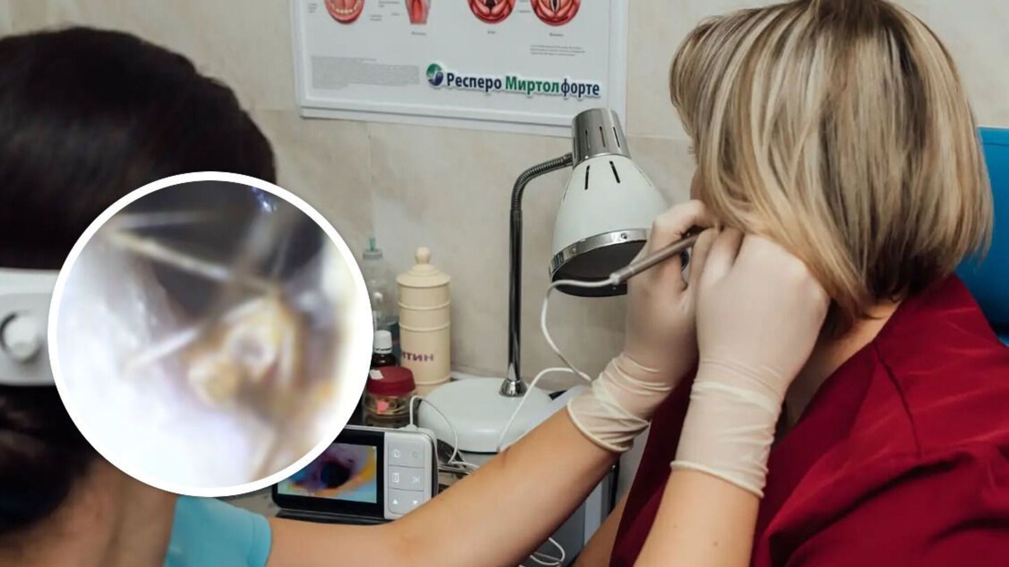 В Ивано-Франковске врачи обнаружили паука в ухе пациентки