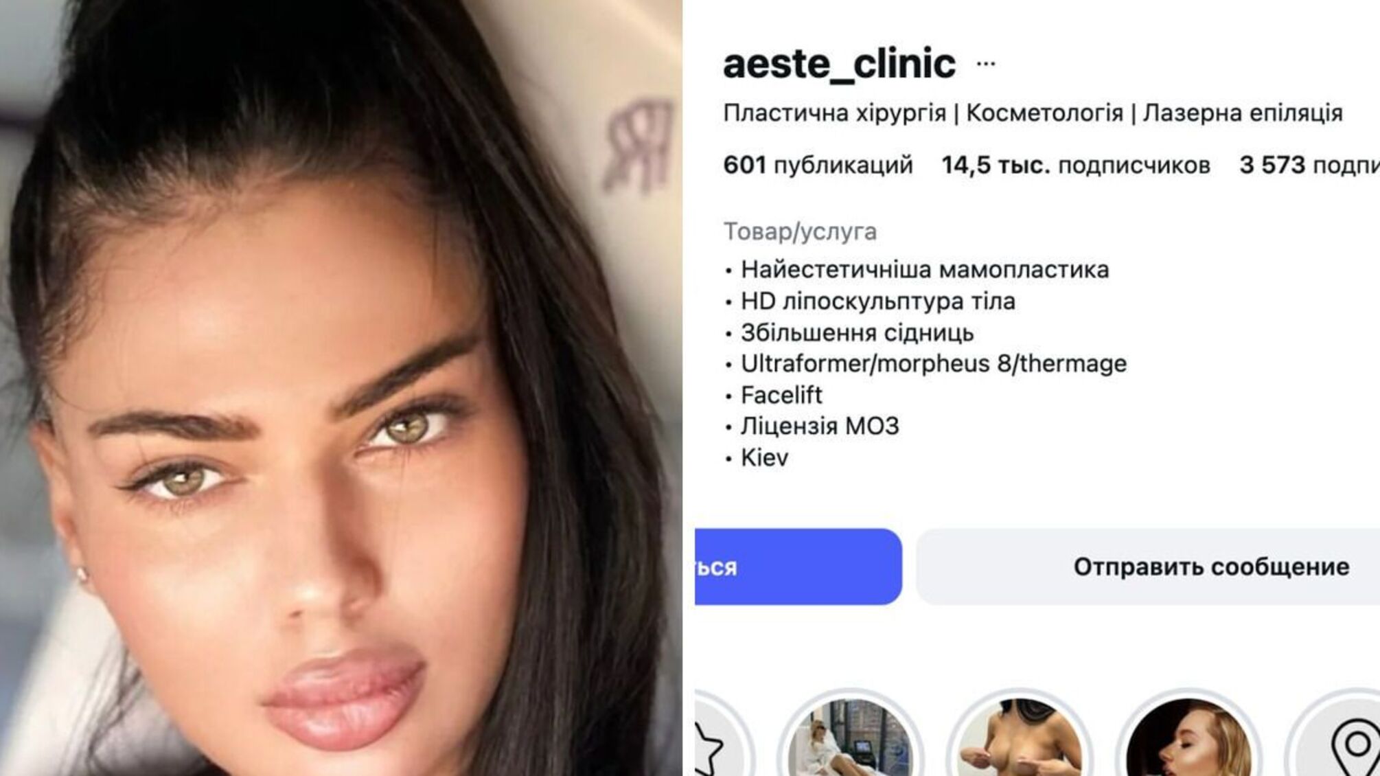 Смерть после инъекций: подозреваемая косметологиня из Молдовы ведет практику в Киеве, - медиа