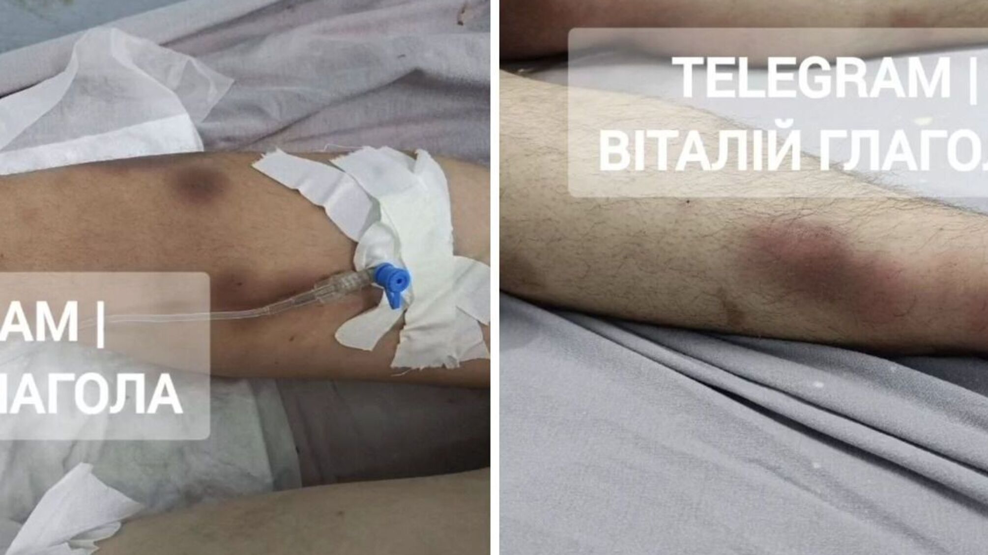 Остановка сердца, запятая и смерть: что известно о гибели мужчины после пребывания в ТЦК, - Глагола